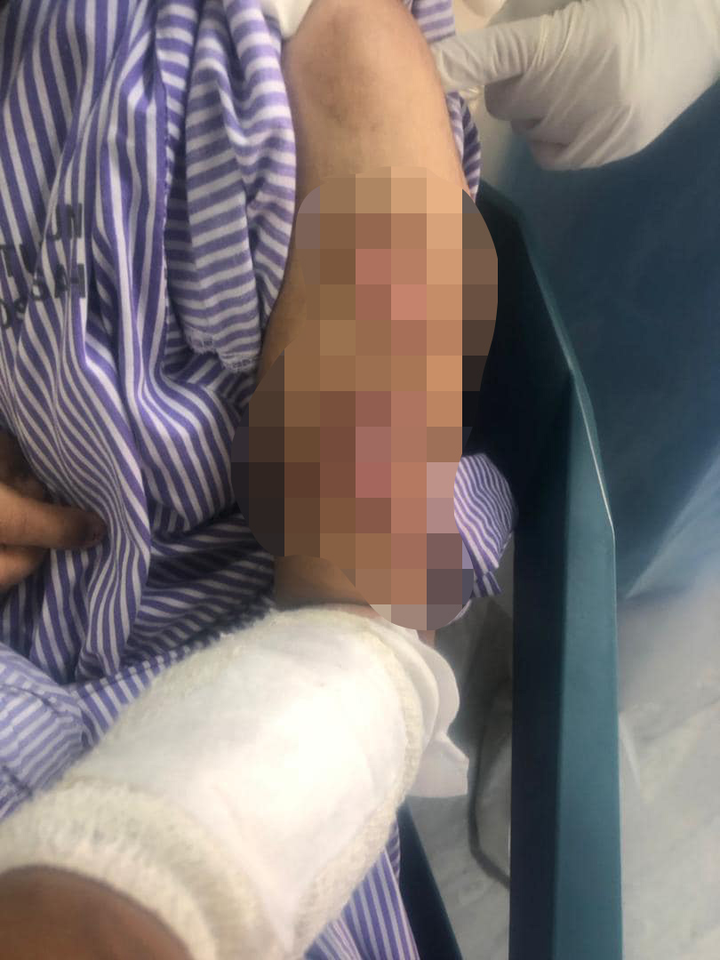 Bella mendedahkan kedua belah tangannya diikat serta disiram air panas.