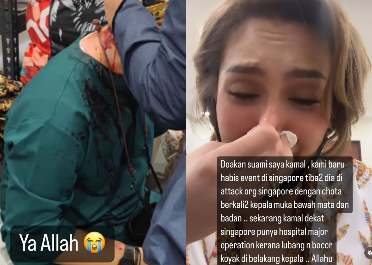Kamal Adli mengalami kecederaan parah di bahagian kepala, muka, bawah mata dan badan selepas diserang seorang lelaki berusia 34 tahun menggunakan cota besi di Singapura pada 13 Mac lalu - Gambar Fail