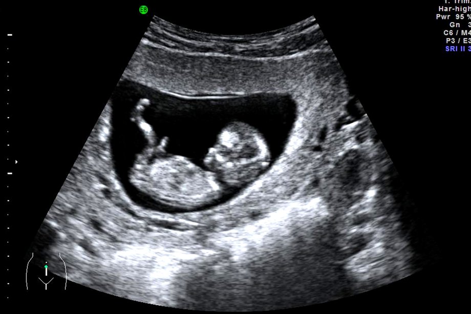 Gambar: Laman web ms.medic-life.com