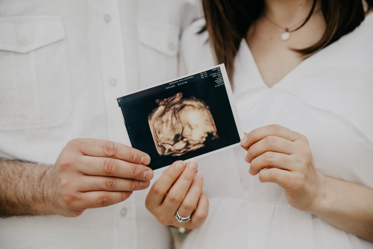 Gambar: Melike Benli, Pexels