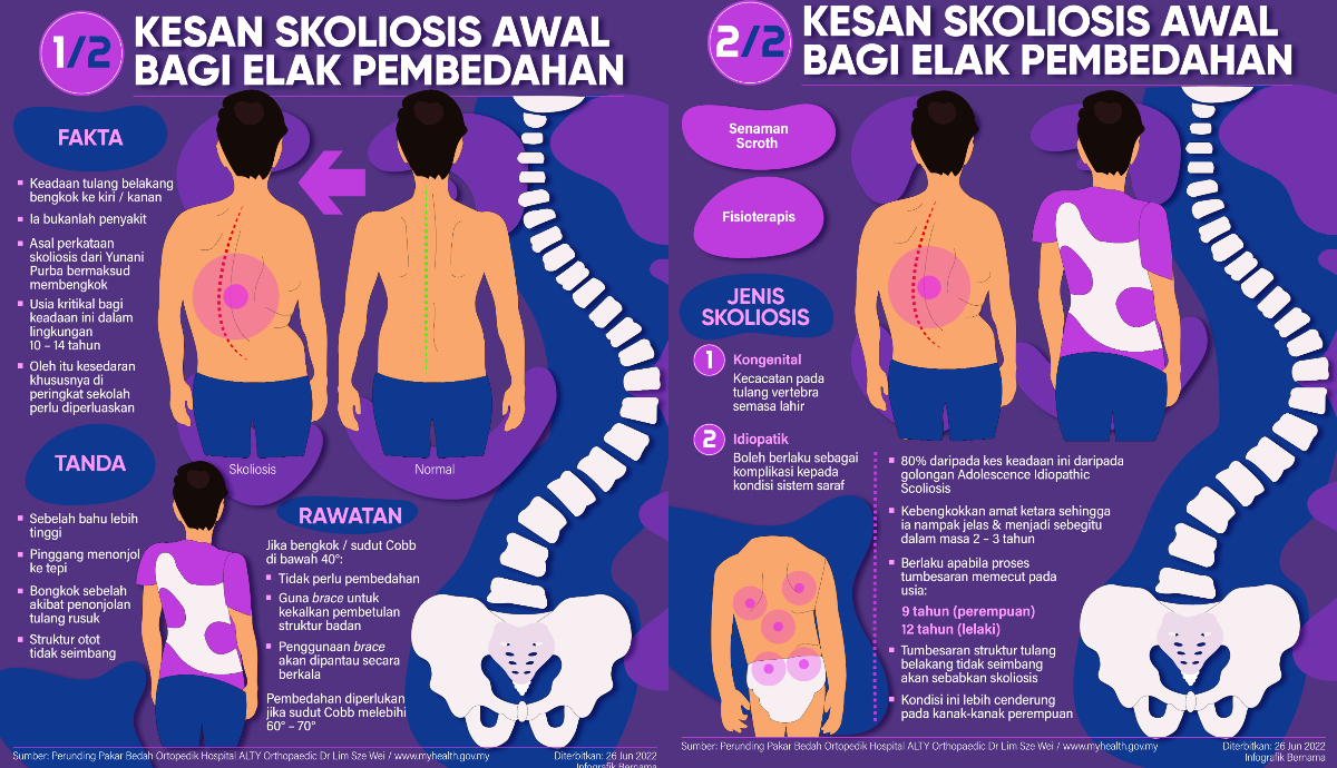 Infografik Bernama