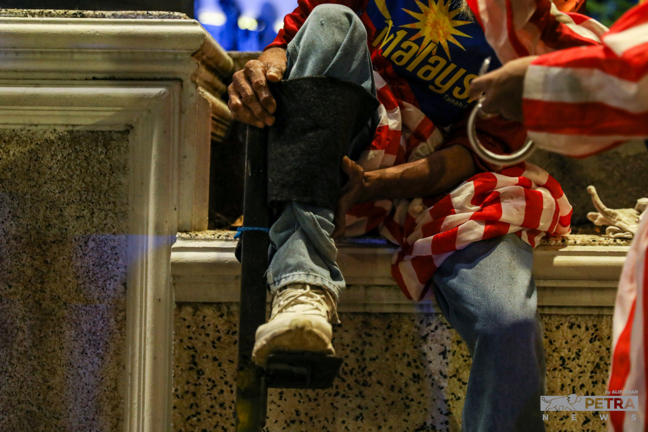 Persediaan sebelum memulakan aksi badut kaki panjang dilakukan dengan berhati-hati.