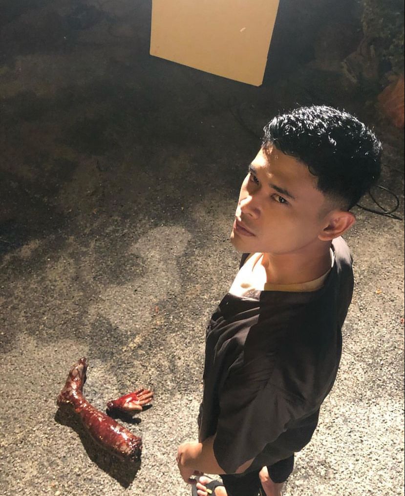 Andi bersyukur kerana dirinya sudah menunjukkan perkembangan positif. - Gambar dari Instagram 