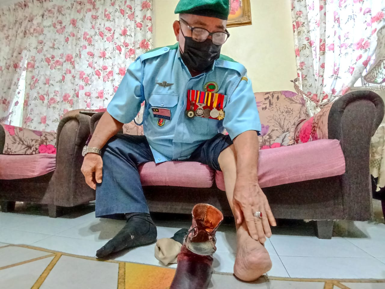 Hussin menunjukkan kakinya yang terkena jerangkap samar.