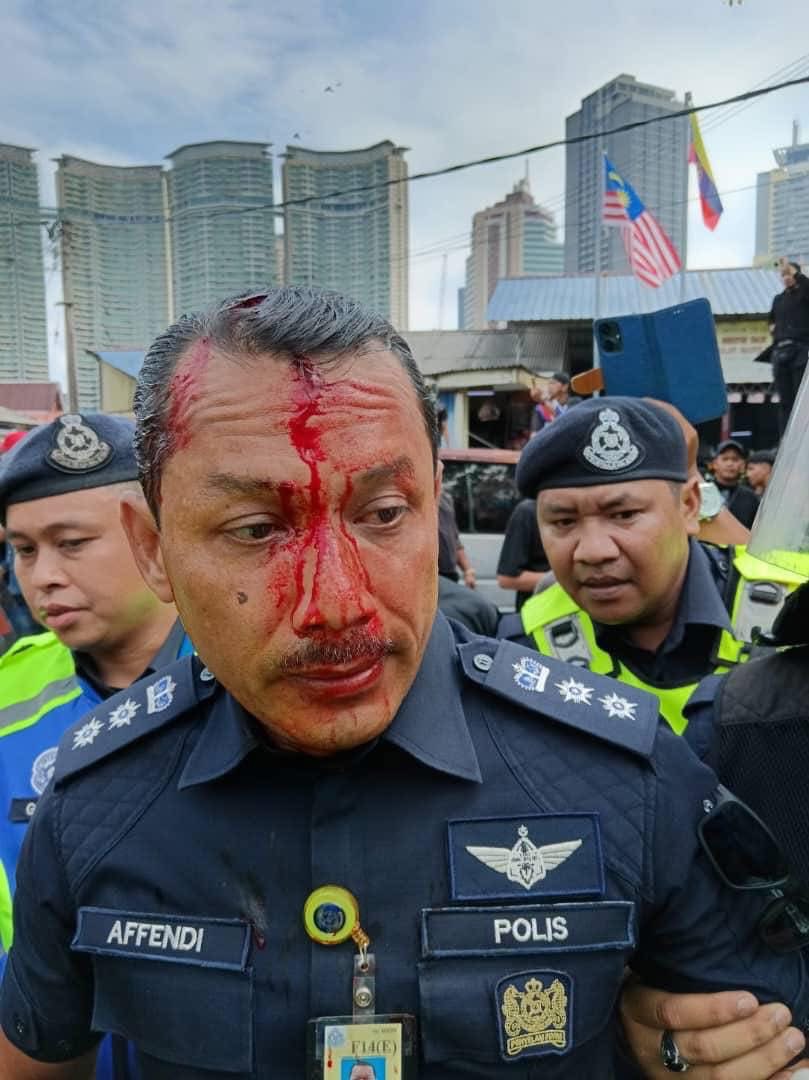 Kepala Sulizmie Affendy Sulaiman cedera, dipercayai kerana dilempar dengan batu - Gambar Facebook
