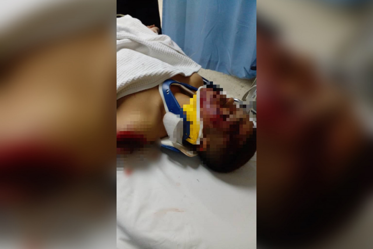 Salah seorang peserta yang mengalami kecederaan serius dan dikejarkan ke Hospital Besar Tawau untuk rawatan.